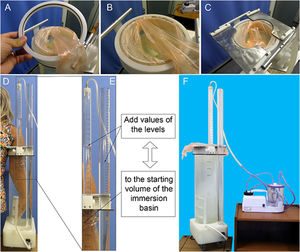 The communicating vessels volumeter (CVV). (A) and (B) glove tied to the fixation ring; (C) metal sheets to restrict glove expansion; (D) introduction of the upper extremity in the immersion basin; (E) reading procedure for volume measurement; and (F) the CVV connected to a suction system for home use.