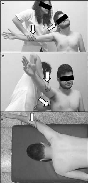 Maximal voluntary isometric contraction tests of the upper trapezius (A), serratus anterior (B), and lower trapezius (C). The arrows indicate the direction of the force applied by the examiner.