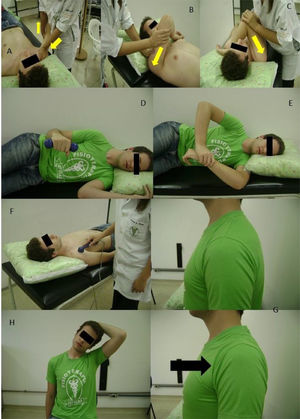 Protocols for the groups: Experimental group: A, B, and C) Progression of posterior capsule mobilization (arrows indicate the mobilization directions), D) Strengthening of the external rotators, E) Posterior capsule stretching; Comparison group: F) Sham ultrasound, G) Scapular squeezing exercise, H) Stretching of the upper trapezius.