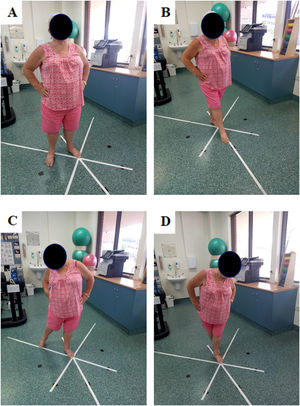 Reach directions of the Star Excursion Balance Test. (A) relaxed stance, (B) anterior, (C) posteromedial, (D) posterolateral.