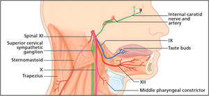 The lowest four cranial nerves are shown emerging from the jugular and hypoglossal foramina, where they join the sympathetic plexus within the carotid sheath. Here, these structures are vulnerable to the compressive effects of the dilatation of the artery resulting from a carotid artery dissection. Reprinted from Fitzerald et al.,45copyright 2007, with permission from Elsevier.