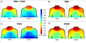 Pressure pain sensitivity maps of the neck and shoulder girdles areas for each group pre- and post-treatment. The maps show higher PPTs in PBM+TENS and TENS groups compared to the PBM and Sham groups post treatment. PBM, Photobiomodulation; PPT, Pressure Pain Threshold; TENS, Transcutaneous electrical nerve stimulation.