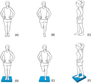 Stances used in Balance Error Scoring System: double-leg stance on firm surface (A); Single-leg stance on firm surface (B); Tandem stance on firm surface (C); double-leg stance on foam surface (D); Single-leg stance on foam surface (E); Tandem stance on foam surface (F).