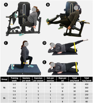 Resistance exercises included in the training program: (A) unilateral leg press, (B) unilateral knee extension, (C) split squat, (D) hip abduction, and (E) clam. The lower panel shows the training periodization for the single-set (SS) and three-set (TS) groups.