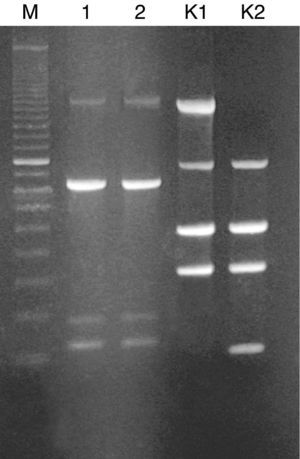 Randomly amplified polymorphic DNA (RAPD) of R. pickettii isolates generated with RAPD-4 primer (5′-AAGAGCCCGT-3′). Lanes: M, standard size marker (100-bp ladder); 1, R. pickettii isolate from the patient's blood; 2, R. pickettii isolate from the hemodialysis fluid; K1, RAPD profile of the reference strain E. coli C1a generated with RAPD-2 primer; K2, RAPD profile of the reference strain E. coli BL21 (DE3) generated with RAPD-2 primer (5′-GTTTCGCTCC-3′).