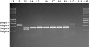 Multiplex PCR assay for SCCmec typing of SA isolates. Multiplex PCR was performed for typing of the SCCmec element in MRSA isolates from the study. Lanes 1 and 12: MW (DNA molecular weight markers). Lane 2: NCTC10442 reference strain (SCCmec type I). Lane 3: N315 reference strain (SCCmec type II). Lane 4: JCSC4744 reference strain (SCCmec type IV). Lanes 5 to 9: MRSA isolates from medical students carrying SCCmec type IV. Lane 10: MRSA isolate from a medical student carrying SCCmec type I. Lane 11: negative control for the PCR assay.