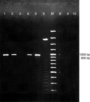 Representative eletroforetic pattern of PCR amplified products of choE in genomic DNA samples of suspected Rhodococcus equi. Lanes 3, 6, 8, 9 and 10 (isolates CAMP test negative); Lanes 1, 2 and 4 (isolates CAMP test positive); Lane 5 reference strain Rhodococcus equi ATCC 6939; M=DNA size marker (100bp).
