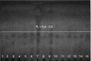 Representative TLC chromatograms on plates of silica gel showing compounds with Rfs corresponding to mycolic-acids separated by dichloromethane. Samples 1-15 are suspected isolates of Rhodococcus equi.