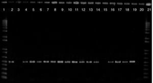 Detection of blaOXA-23-like genes in Acinetobacter spp. clinical isolates. Lines 1 and 21: 1 Kb Plus DNA Ladder; line 2: blaOXA-23 positive control; line 3: blaOXA-23 negative control; lines 4-14 and 16-19: isolates carrying blaOXA-23; line 15: isolate not carrying blaOXA-23; line 20: reaction control.