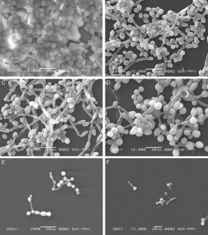 Scanning electron micrographs of FLC and VOR antifungal drugs alone and in combination with CQ, against biofilm development of C. albicans (ATCC 90028). (A) Control; (B) CQ alone 250μg/mL; (C) FLC alone (128μg/mL); (D) VOR alone (8μg/m); (E) 4μg/mL FLC+250μg/mL CQ; (F) 0.25μg/mL+250μg/mL CQ.