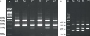 Photograph of the PCR products of the TLR2 Arg677Trp (rs1695 A/G) gene (A) and 597T/C polymorphism (B). M, DNA marker.