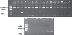 PCR amplification results of HLA-DRB1 Alleles. Positive bright band appeared in Lanes 3, 6, 8, representing the allelotypes of HLA-DRB1 were HLA-DRB1*1501-1502, 0301, 0401-0414-1401. And Lanes 21, 22, 23 represent DRB3, DRB4, and DRB5, respectively. Each lane includes an internal PCR control amplicon of human growth hormone gene (about 800bp concordant with theoretical values).