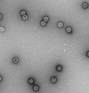 Purified HPV16 L1 VLP. VLP were purified from recombinant baculovirus-infected Sf9 cells on CsCl gradients, stained with uranyl acetate, and observed by TEM. Magnification, ×50,000.