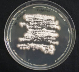 Culture of Microsporum nanum on Sabouraud dextrose agar with chloramphenicol.