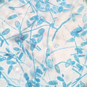 Microsporum nanum macroconidia on lactophenol blue stain. 40×.