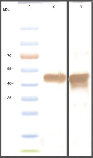 Western blot analysis rCS6: (A) using anti 6X-His-tag antibodies. Lane 1: protein weight marker. Lane 2: rCS6 and (B) using anti-CTXB. Lane 1: protein weight marker, Lane 2: rCS6, Lane 3: antibody. Negative control (bacterial lysate without IPTG induction).