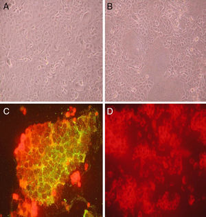 Isolation and pathological diagnosis of measles virus by cytopathic effect (CPE) and indirect fluorescence assay. Vero-SLAM cells were infected with control cell culture media (A, D) and virus collected from throat swabs (B, C) for 72h. Cells infected with virus collected from throat swabs showed obvious CPE (B) while cells infected with control media were normal (A). Indirect fluorescence assay was performed on cells infected with control virus and throat swab material. Viral infected cells showed peripheral green fluorescence staining (C) which was absent in control cells (D).