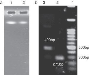 Agarose gel electrophoresis of extracted E. coli O157:H7 and Shigella dysenteriae genomic DNA and analysis of PCR products. (a) Lane 1, E. coli O157:H7 genomic DNA; Lane 2, Shigella dysenteriae's genomic DNA. (b) Lane 1, 100bp DNA ladder; Lane 2, PCR product (275bp) for stx2; Lane 3, PCR product (490bp) for stx1.