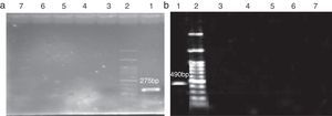 Specificity of PCR detection of E. coli O157:H7 (a) and Shigella dysenteriae (b). Lane 1, positive control; Lane 2, 100bp DNA ladder; Lane 3, Pseudomonas aeruginosa; Lane 4, Klebsiella pneumonia; Lane 5, Vibrio cholera; Lane 6, Salmonella typhimurium; Lane 7, Salmonella paratyphi C.