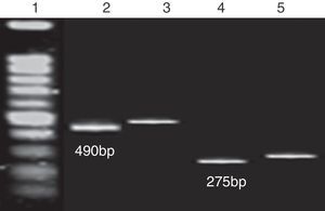 Representative electrophoretic gels of PCR products labeled with digoxigenin. Lane 1, 100bp DNA ladder; Lane 2, PCR product of stx1 from Shigella dysenteriae genomic DNA; Lane 3, PCR product of stx1 from Shigella dysenteriae genomic DNA labeling with dNTP DIG mix; Lane 4, PCR product of stx2 from E. coli O157:H7 genomic DNA; Lane 5, PCR product of stx2 from E. coli O157:H7 genomic DNA labeling with dNTP DIG mix.