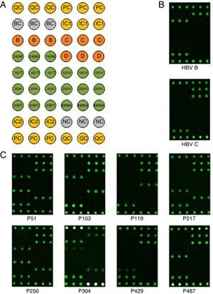 Microarray-based HBV genotyping and drug resistance-related mutations. (A) Layout of the microarray used in the current study. All probes, with the exception of QC and PC, were spotted in three replicates; QC and PC were spotted in six replicates. QC and BC were the positive and negative controls for array production, respectively. PC and NC were the positive and negative controls for hybridization, and IC1 and IC2 were the internal controls for HBV amplification, respectively. B, C, and D represent HBV genotypes B, C, and D, respectively. 180M, 181T/V, 204I/V, and 236T represent the rtL180M, rtA181T/V, rtM204I/V, and rtN236T, respectively, mutations in the HBV reverse transcriptase region. 1896A denotes the G1896A mutation in the HBV precore region. (B) Hybridization results of the classical HBV samples with genotypes B and C. (C) Hybridization results of eight classical NA-resistant samples.