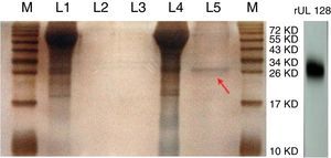 Silver stain of recombinant UL128 protein. M: Marker, L1: Supernatant of CHO-Vector, L2: Purification lipid of CHO-Vector supernatant, L3: Blank control, L4: Supernatant of CHO-UL128; L5: Purification lipid of CHO-UL128 supernatant, rUL128: Western Blot of recombinant UL128 (using anti-Histag).