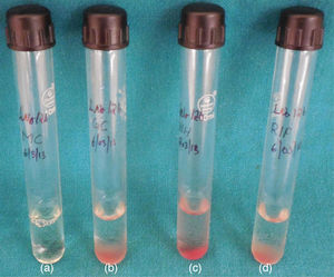 Photograph showing red ring formation in the direct TTC assay [from left to right (a) media control tube, (b) growth control tube, (c) isoniazid resistant and (d) rifampicin resistant].