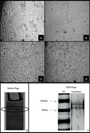 Cytotoxicity of SEPEC cytotoxic factor on HUVEC. (A) HUVEC Cell Control, (B) HUVEC treated with E. coli K12 C600 culture supernatant, (C) HUVEC treated with chromatographic fractions (Superose 12 10/300GL), (D) HUVEC treated with SEPEC 15 culture supernatant. After treatment, all cells were incubated for 24h. Magnification for all images: 200×. Electrophoretic profile of purified cytotoxic factor in (E) native PAGE showing a single protein band and (F) SDS-PAGE showing two protein bands with molecular masses between 70 and 100kDa. **Active fractions obtained by gel filtration on Superose 12 10/300GL were run in both cases. *M – molecular mass markers.