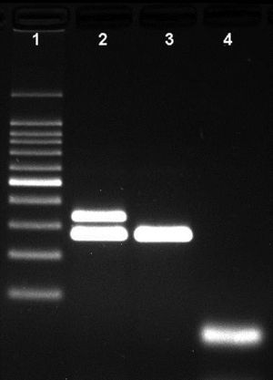 Agarose gel showing the differentiation of capsulated and non-capsulated Haemophilus influenzae strains. Lane 1: 100bp DNA ladder; lane 2: capsulated H. influenzae (bexA and P6 genes with 343bp and 273bp respectively); lane 3: non-capsulated H. influenzae (HiNT), (bexA gene with 343bp); lane 4 negative control.