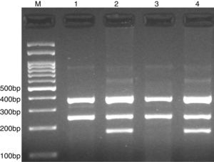 Photograph of tetra amplification refractory mutation system-polymerase chain reaction (T-ARMS-PCR) for detection of CISH rs2239751 A>C polymorphism. Product sizes were 180-bp for C allele, 251-bp for A allele, and 376-bp for control. M, DNA Marker; Lanes 1 and 3, AA; Lanes 2 and 4, AC.