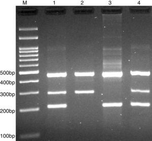 Photograph of tetra amplification refractory mutation system-polymerase chain reaction (T-ARMS-PCR) for detection of CISH rs414171 A>T polymorphism. Product sizes were 208-bp for T allele, 290-bp for A allele, and 452-bp for control. M, DNA Marker; Lanes 1 and 4, AT; Lane 2, AA; Lane 3, TT.