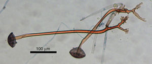 Microscopic examination of Rhizopus arrhizus: unbranched sporangiospores with collapsed columella and rhizoids. Bar: 100μm.