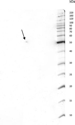 Bidimensional electrophoresis of P. shigelloides LCE. The revealed spot indicated by the arrow shows a protein of 50kDa and isoelectric point (pI) of 6.8, indicating that this bacterium virulence factor can adequately be obtained and purified by chromatographic processes.