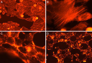 FAS assay on Vero cells show morphological and intracellular alterations. (A) Cell control; (B) formation of stress fibers; (C) rounding of cells; (D) dead cells.