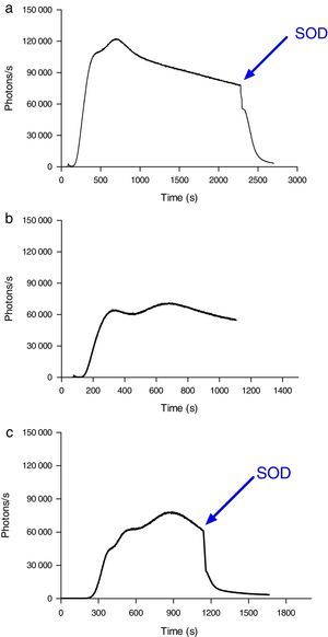 ROS production by neutrophils during contact with erythrocytes, as measured by chemiluminescence. (A) ROS production by neutrophils in the presence of erythrocytes from septic patients. The SOD inhibitor of superoxido was added to some samples. (B) ROS production by neutrophils in the presence of erythrocytes from healthy volunteers. (C) ROS production by neutrophils during contact with erythrocytes that had been oxidatively modified in vitro by treatment with peroxynitrite. The SOD inhibitor of superoxido was added to some samples. The results are representative of three patients.