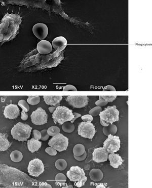 Visualization by scanning electron microscopy of the phagocytosis of erythrocytes by J774 macrophages. Macrophages and erythrocytes were incubated for 1h at 37°C and then fixed with Karnovsky. (A) Adhesion and phagocytosis of oxidatively modified erythrocytes from a septic patient by J774 macrophages. (B) Erythrocytes from healthy volunteer in presence of J774 macrophages.