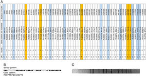 Genotypic profile of the isolate from Salvador, Bahia, Brazil assigned to the EAI6-BDG1 spoligotyping subfamily (SIT 702). (A) Single Nucleotide Polymorphisms (SNPs). Loci highlighted in blue show polymorphisms uniquely identified in the East African-Indian (EAI) strain as compared to the other 351 genotyped isolates in this series. Loci highlighted in orange show the SNPs that were also distinctive of EAI, according to Lopes et al.12 (B) Spoligotyping pattern. (C) Restriction-fragment length polymorphism (RFLP).