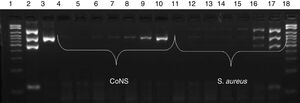 Sensitivity of multiplex PCR. Electrophoresis gel showing the amplification of different dilutions of CoNS and S. aureus. Lane 1: 100–2000bp molecular weight marker; 2: mecA-positive S. aureus ATCC; 3: S. epidermidis ATCC; 4: CoNS 10−7 dilution (10CFU/mL); 5: 10−6 (102CFU/mL); 6: 10−5 (103CFU/mL); 7: 10−4 (104CFU/mL); 8: 10−3 (105CFU/mL); 9: 10−2 (106CFU/mL); 10: 10−1 (107CFU/mL), 11: S. aureus 10−7 dilution (10CFU/mL); 12: 10−6 (102CFU/mL); 13: 10−5 (103CFU/mL); 14: 10−4 (104CFU/mL); 15: 10−3 (105CFU/mL); 16: 10−2 (106CFU/mL); 17: 10−1 (107CFU/mL); 18: 100–2000bp molecular weight marker.