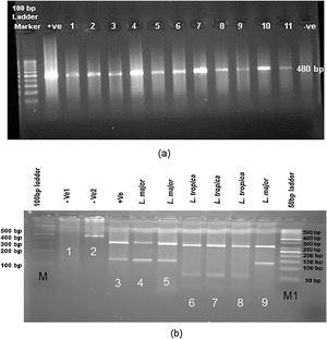 (a) Leishmania positive results isolated from freshly ulcers of suspected patients by PCR targeting ITS-rDNA genotype without RFLP. (b) PCR-RFLP observation in Yazd isolates based on ITS-rDNA genotype. Lane 1 (−ve, negative control containing BsuR1 without PCR product), lane 2 (−ve: negative control containing PCR product without BsuR1), lane 3 (+ve, positive control for L. major), lanes 4, 5; Yaz32 and Yaz19 (L. major, common haplotypes): isolated from wet lesions of suspected patients in Esfand-Abad and Chahgir, respectively. Lanes 6–8; MH488992 (Yaz58), MH492002 (Yaz60), and MH488993 (Yaz61) (L. tropica, three Novel haplotypes): isolated from dry lesions of suspected patients western and southern Yazd, Lane 9; Yaz27; L. major isolated from wet lesion of suspected patient, central Yazd. M, 100 bp size marker; M1, 50 bp size marker; –ve, negative; +ve, positive.