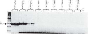 Sensitivity of the SCAR300 marker. PCR was performed with different DNA concentrations of the C. posadasii (HU-1) reference strain, as described in the Materials and Methods section. Positive control (+); negative control (−); bp (molecular size marker).