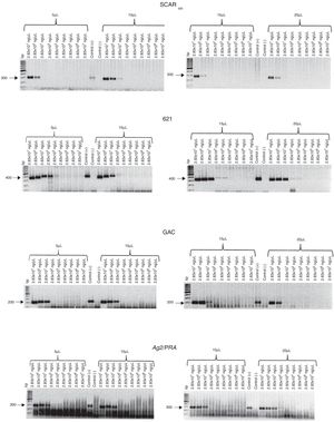 Sensitivity of the SCAR300, 621, GAC2, and Ag2/PRA markers. Different volumes (5, 10, 15, and 20 µL) of total DNA obtained from blood spiked with different concentrations of C. posadasii reference strain (HU-1) DNA were used. Positive control (+); negative control (−); bp (molecular size marker).