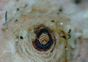 Pigidial area and respiratory spiracles of Tunga Penetrans.