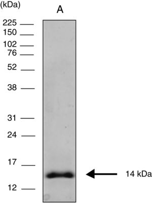Electrophoresis of the COOH-terminal region of the CPB protein (rcyspep). Electrophoresis was carried out to assess rcyspep protein (10μg) profiles under denaturing conditions; only one protein of 14kDa was obtained (A). The molecular mass standard proteins (kDa) are indicated on the left.
