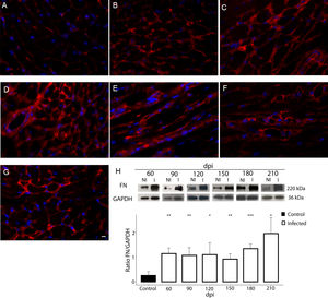 Fibronectin (FN) expression in chronically infected C57BL/6 mice. (A) FN spatial distribution in the myocardium of uninfected mice. (B–G) Thick deposition of FN was observed in the cardiac tissue of T. cruzi-infected mice. Intense fluorescence signal in the myocardium interstitium was observed at 60 (B), 90 (C), 120 (D), 150 (E), 180 (F) and 210 dpi (G). Representative immunoblotting image and densitometric analysis showing a significant increase of FN expression in acute (60 dpi) and chronic infection (90–210 dpi) (H). DAPI (blue) stained the nucleus. Bar=10μm. GAPDH was used as an internal control for protein normalization. Student’s t-test: *p≤0.05; **p≤0.01; ***p≤0.001.
