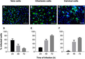 Kinetics of ZIKV infection in cell cultures. The detections of the viral antigen (green) and nucleus of host cells (blue) were performed by immunofluorescence: (A) Vero cells were infected with ZIKV at a MOI of 1 for 24 h, (B) chorionic cells at a MOI of 20 and (C) cervical cells at a MOI of 10 for 48 h. The graphs represent the means ± standard deviations of the percentage of infected cells during the infection kinetics in (D) Vero, (E) chorionic and (F) cervical cells. The data are representative of 3–5 experiments run in duplicate. Bars (A and B) 100 µm, (C) 50 µm.