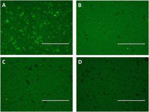 Immune complexes detection by immunofluorescence using epoxy beads coupled by scFv and pooled human sera positive for strongyloidiasis (A) and other parasites (B) and pooled sera from healthy individuals (C), labeled with anti-human IgG/FITC. As a negative control were used scFv coupled beads and added anti-human IgG/FITC (D). Bar: 200μm.