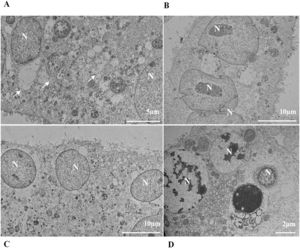 Syncytium formation. (A) Vero-E6 cells 48 hpi with the Gamma variant. (B) Vero-E6 cell 48 hpi with Zeta variant. (C) Vero-E6 cells 48 hpi with Alpha variant. (D) Vero-E6 cells 24 hpi with Delta variant. SARS-CoV-2 particles (white arrows), nucleus (N). TEM images.
