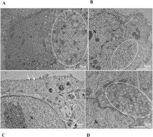 Proliferation of double-membrane vesicles (circled area) in Vero-E6 cells infected with SARS-CoV-2 variants. (A) Cell 24 hpi with Gamma. (B) Cell 48 hpi with Zeta. (C) Cell 48 hpi with Alpha. (D) Cell 48 hpi with Delta. SARS-CoV-2 particles (white arrows). Nucleus (N). TEM images.