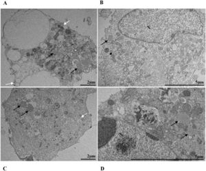 Lipid droplet accumulation (black arrows) in Vero-E6 cells infected with SARS-CoV-2 variants. (A) Cell 72 hpi with Gamma. (B) Cell 48 hpi with Zeta. (C) Cell 72 hpi with Alpha. (D) Cell 48 hpi with Delta. SARS-CoV-2 particles (white arrows). Nucleus (N). TEM images.