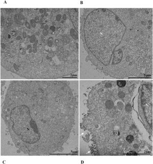 Electron-dense ribosomes in Vero-E6 cells infected with SARS-CoV-2 variants. (A) Cell 24 hpi with gamma. (B) Cell 48 hpi with Zeta. (C) Cell 72 hpi with Alpha. (D) Cell 48 hpi with Delta. SARS-CoV-2 particles (white arrows). Nucleus (N). TEM images.